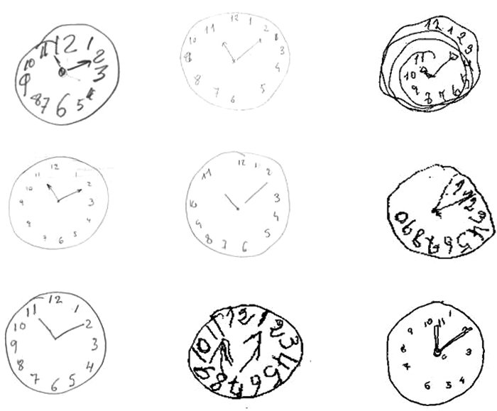 Las pruebas de dibujo del reloj realizadas por personas mayores